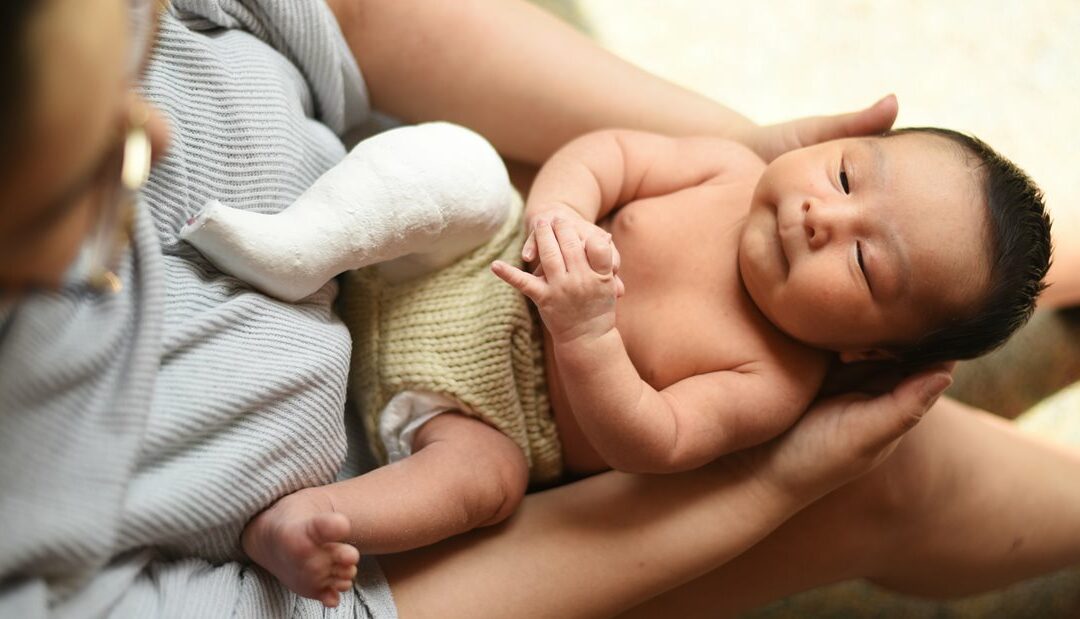 Prenatal Care for Clubfoot – What Expecting Moms Need to Know