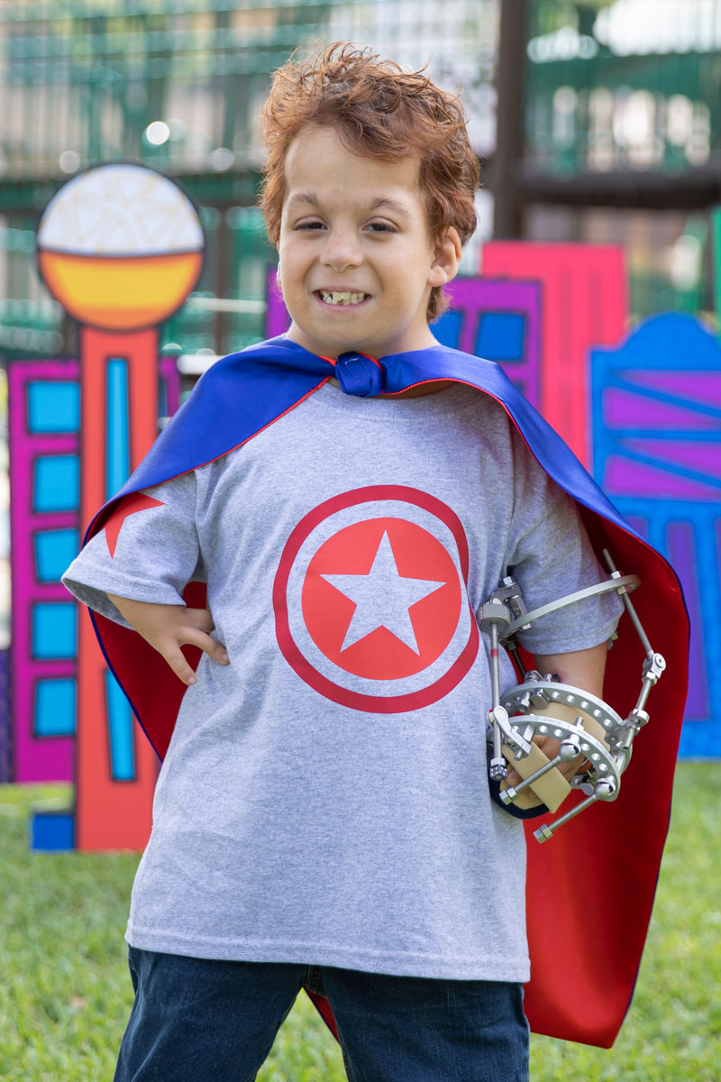 limb-reconstrucion-boy-arm-cape-800x1200